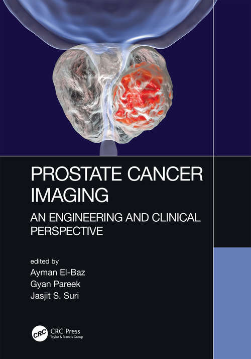 Prostate Cancer Imaging: An Engineering and Clinical Perspective