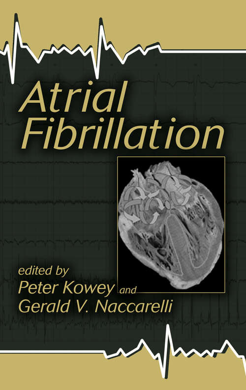 Atrial Fibrillation (Fundamental And Clinical Cardiology Ser. #Vol. 50)