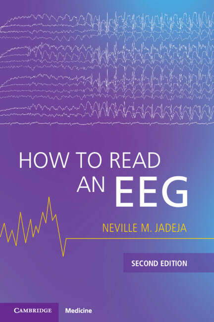Book cover of How to Read an EEG (2)