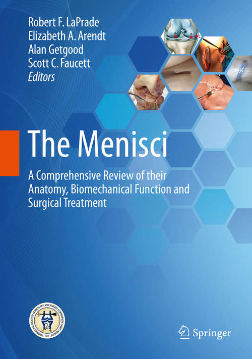 The Menisci: A Comprehensive Review Of Their Anatomy, Biomechanical Function And Surgical Treatment