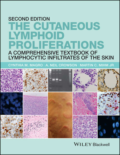 Book cover of The Cutaneous Lymphoid Proliferations