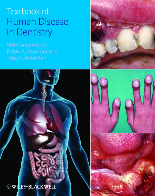 Textbook of Human Disease in Dentistry