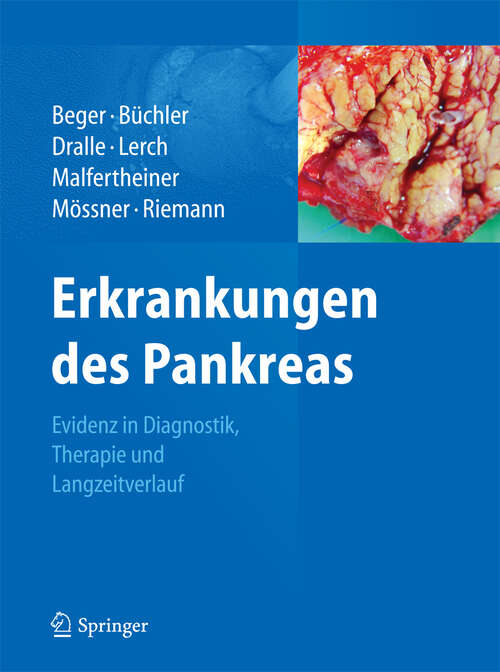 Book cover of Erkrankungen des Pankreas