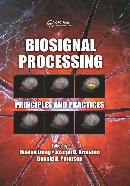 Biosignal Processing: Principles and Practices