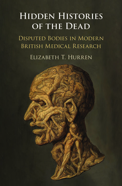 Book cover of Hidden Histories of the Dead: Disputed Bodies in Modern British Medical Research