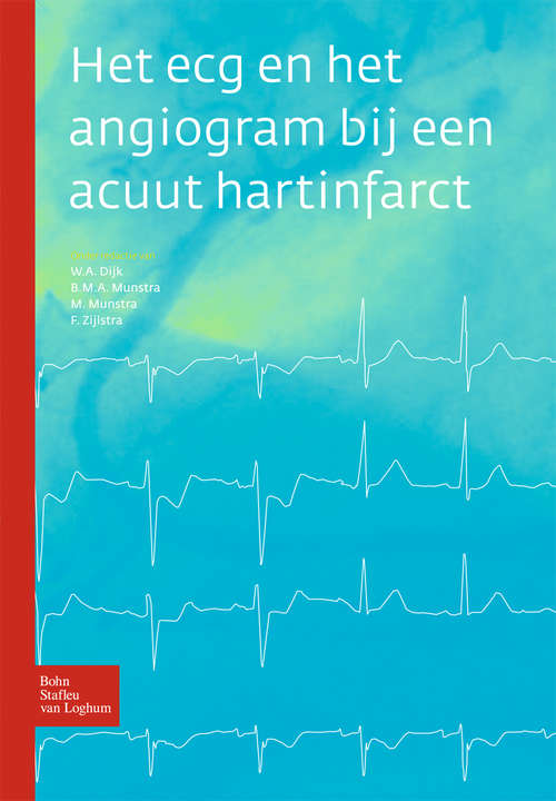 Book cover of Het ecg en het angiogram bij een acuut hartinfarct