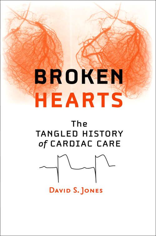 Broken Hearts: The Tangled History of Cardiac Care