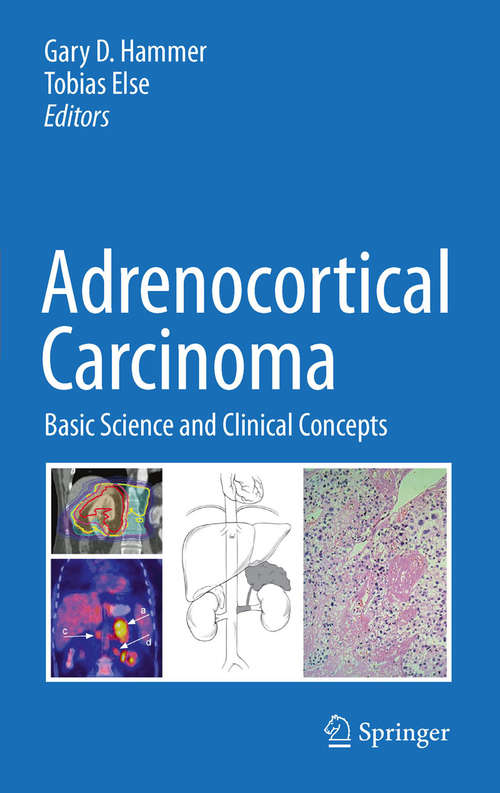 Adrenocortical Carcinoma: Basic Science and Clinical Concepts