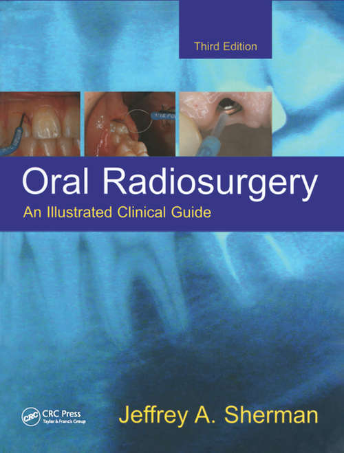Oral Radiosurgery: An Illustrated Clinical Guide