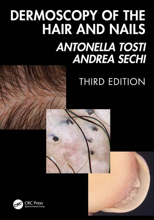 Book cover of Dermoscopy of the Hair and Nails 3e (3)