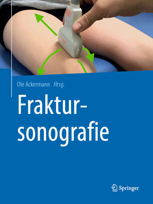 Book cover of Fraktursonografie (1. Aufl. 2019)
