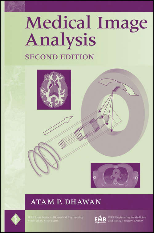 Medical Image Analysis, 2nd Edition
