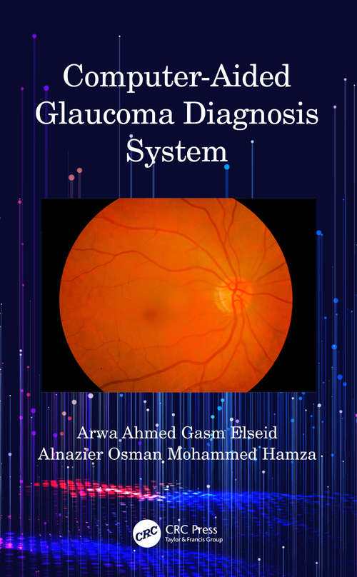 Computer-Aided Glaucoma Diagnosis System