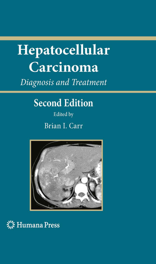 Book cover of Hepatocellular Carcinoma