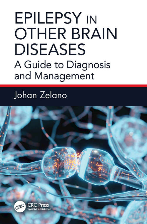 Book cover of Epilepsy in Other Brain Diseases: A Guide to Diagnosis and Management (1)