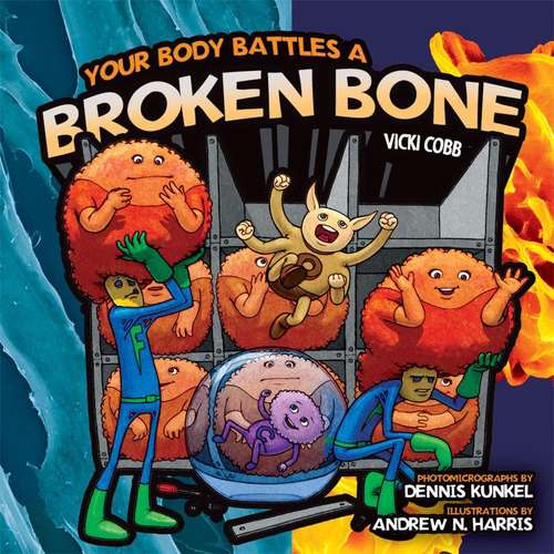 Book cover of Your Body Battles a Broken Bone