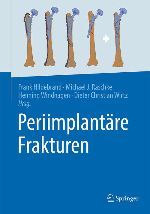 Book cover of Periimplantäre Frakturen