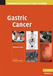 Book cover of Gastric Cancer