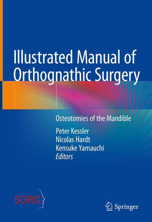 Book cover of Illustrated Manual of Orthognathic Surgery: Osteotomies of the Mandible (2024)