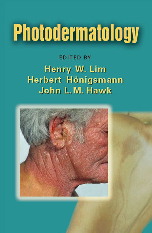 Photodermatology (Basic And Clinical Dermatology Ser. #38)