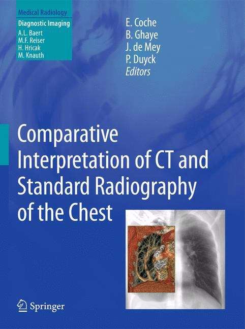 Comparative Interpretation of CT and Standard Radiography of the Chest (Medical Radiology)