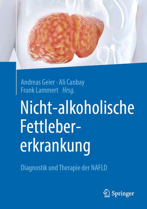 Book cover of Nicht-alkoholische Fettlebererkrankung: Diagnostik und Therapie der NAFLD (1. Aufl. 2022)