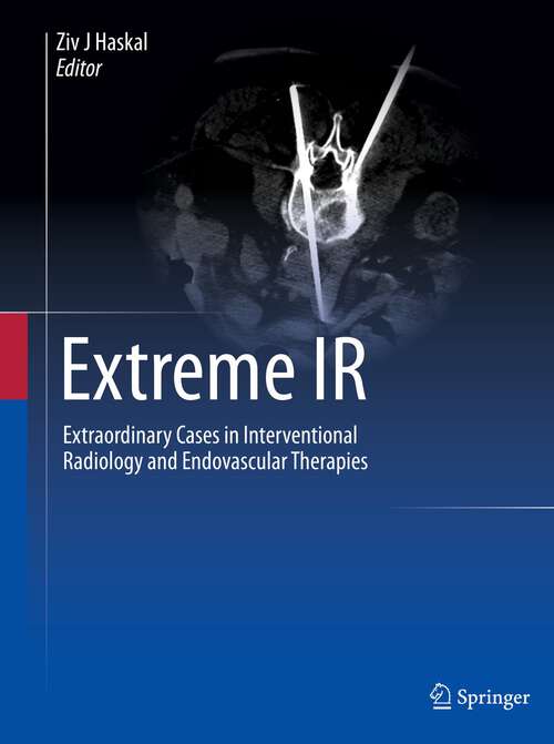Book cover of Extreme IR: Extraordinary Cases in Interventional Radiology and Endovascular Therapies (1st ed. 2023)
