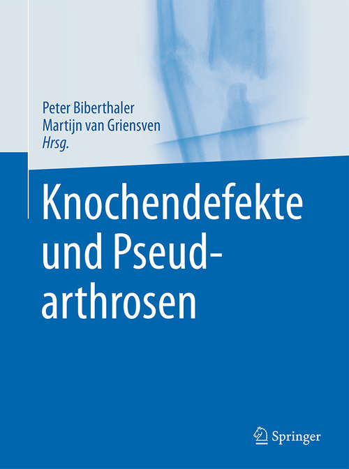 Book cover of Knochendefekte und Pseudarthrosen