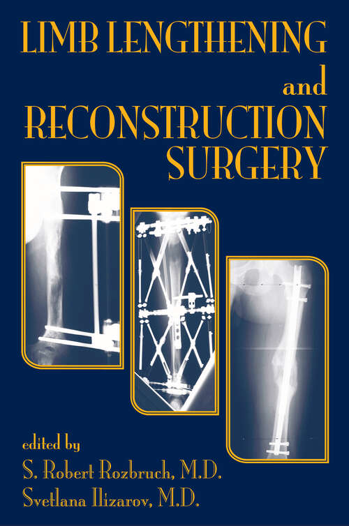 Book cover of Limb Lengthening and Reconstruction Surgery