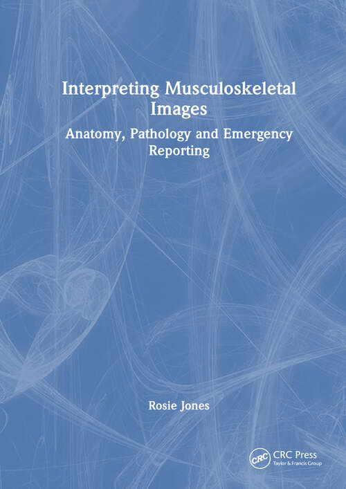 Book cover of Interpreting Musculoskeletal Images: Anatomy, Pathology and Emergency Reporting