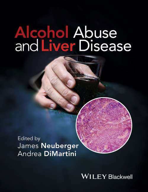 Alcohol Abuse and Liver Disease