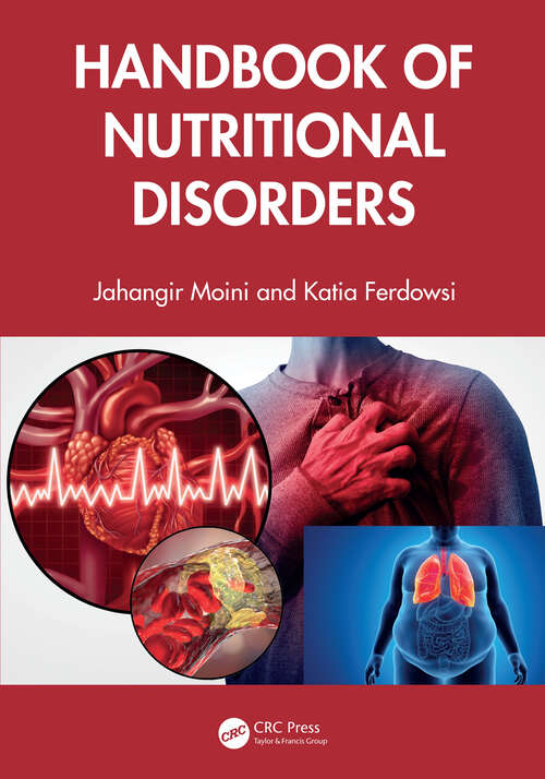 Book cover of Handbook of Nutritional Disorders (1)