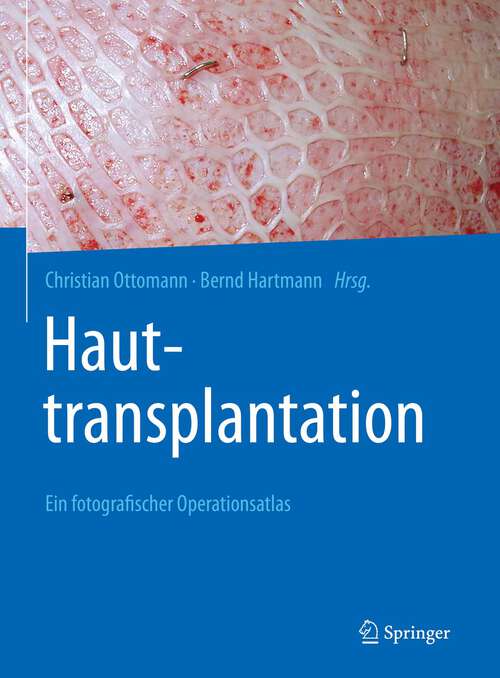 Book cover of Hauttransplantation: Ein fotografischer Operationsatlas (1. Aufl. 2022)