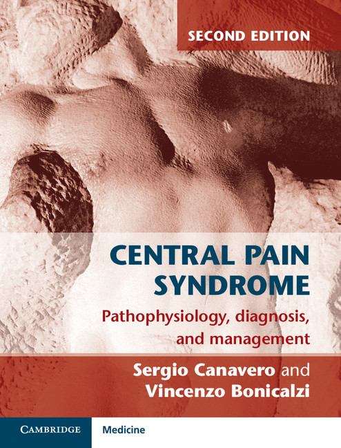 Book cover of Central Pain Syndrome: Pathophysiology, Diagnosis and Management