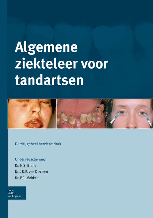 Book cover of Algemene ziekteleer voor tandartsen