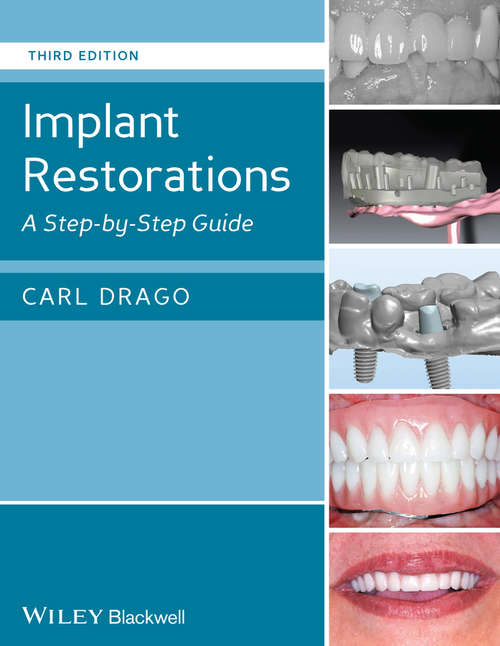 Book cover of Implant Restorations