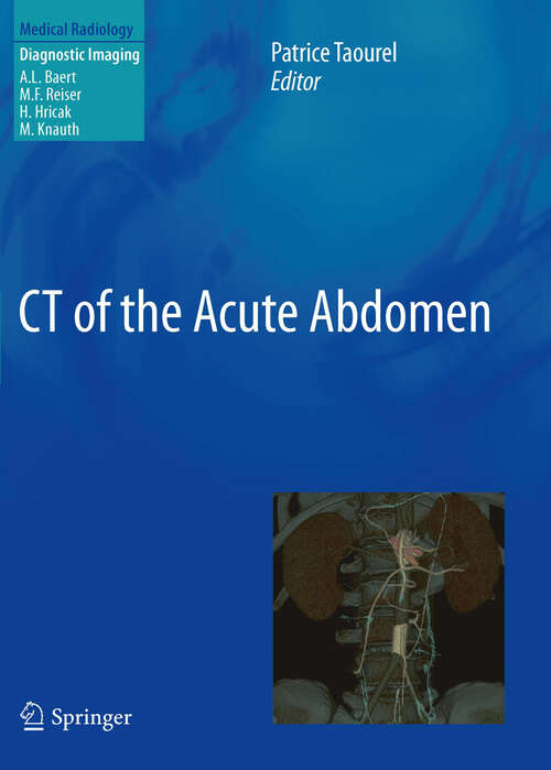 Book cover of CT of the Acute Abdomen (Medical Radiology)