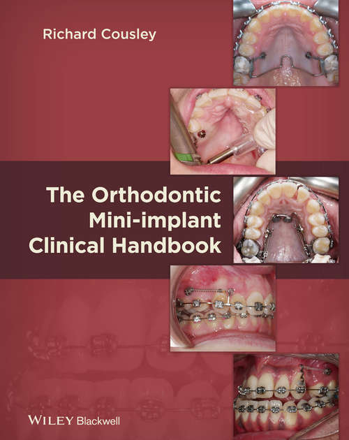 Cover image of The Orthodontic Mini-implant Clinical Handbook