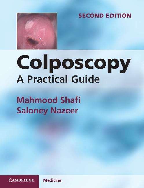 Book cover of Colposcopy