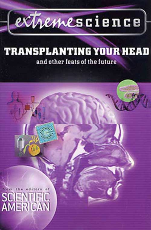 Extreme Science: Transplanting Your Head And Other Feats of the Future