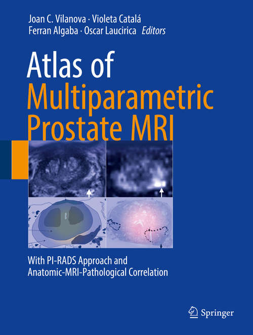 Book cover of Atlas of Multiparametric Prostate MRI